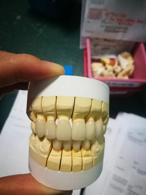 China dental lab expert